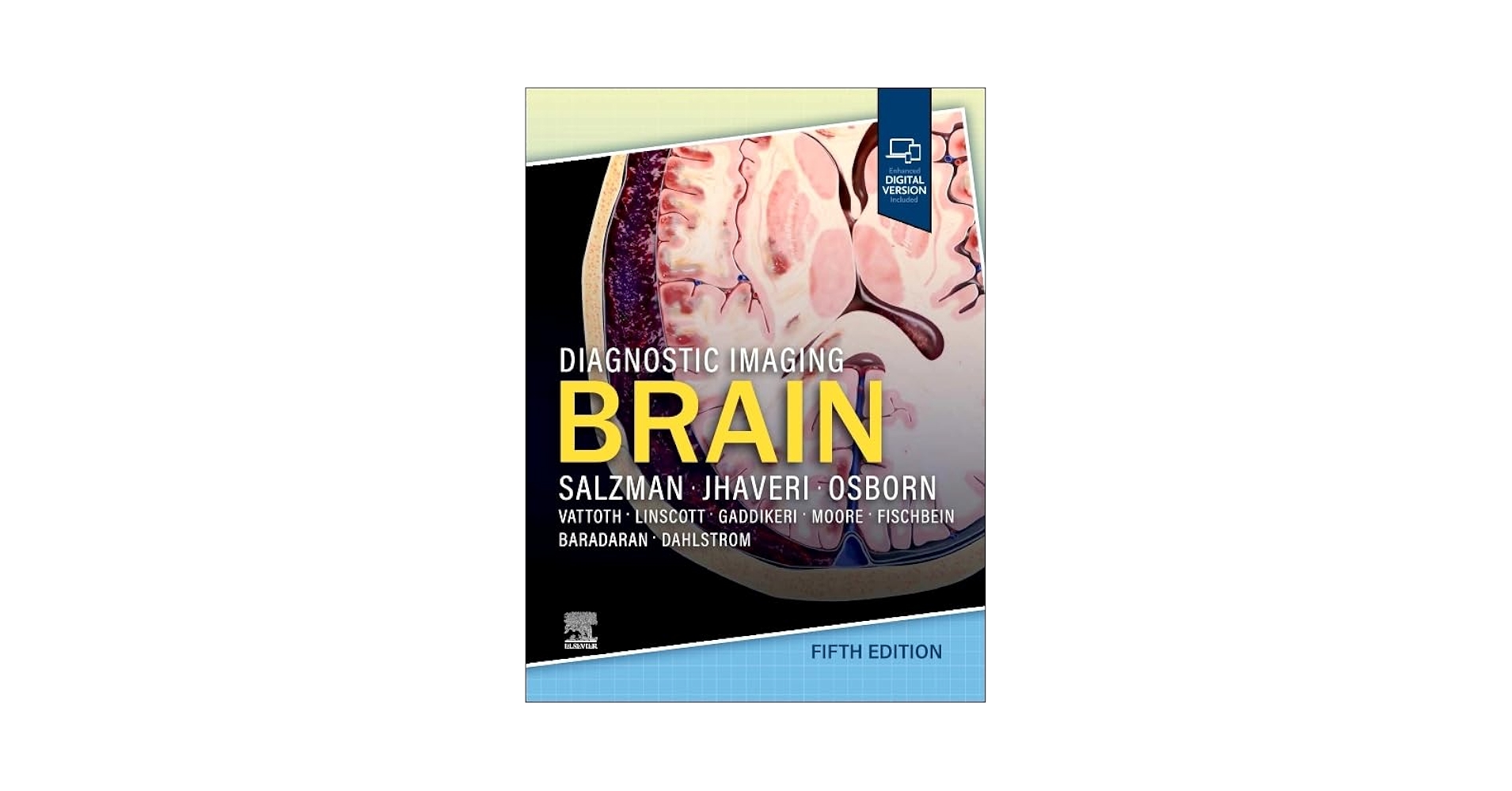 健康・医学 DIAGNOSTIC IMAGING BRAIN Diagnostic Imaging: Brain: 9780323377546: Medicine & Health